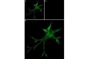 Unlabeled ω-Conotoxin MVIIC successfully blocks ω-Conotoxin MVIIC-Biotin binding. (Conotoxin MVIIC omega peptide (Biotin))