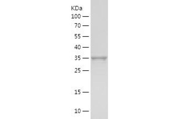 Lipoprotein Lipase Protein (LPL) (AA 311-475) (His-IF2DI Tag)