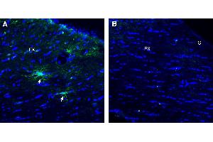 Immunohistochemical staining of perfusion-fixed frozen mouse brain sections using Anti-TMEM108 (extracellular) Antibody (ABIN7885615), (1:300), followed by goat anti-rabbit-. (TMEM108 抗体  (Extracellular Loop))