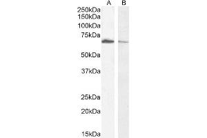 Western Blotting (WB) image for anti-Acetylcholinesterase (AChE) (C-Term) antibody (ABIN185357)