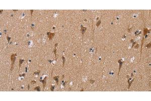 Immunohistochemistry of paraffin-embedded Human brain using POMT1 Polyclonal Antibody at dilution of 1:50 (POMT1 抗体)