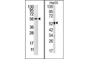 Image no. 1 for anti-Dual Specificity Phosphatase 4 (DUSP4) (C-Term) antibody (ABIN360778) (DUSP4 抗体  (C-Term))