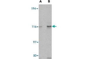 Western blot analysis of KIF5A in K-562 cell lysate with KIF5A polyclonal antibody  at (A) 0. (KIF5A 抗体  (C-Term))