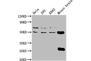 Western Blotting (WB) image for anti-Tubulin beta 4a (TUBB4A) (AA 1-444) antibody (ABIN7173691)
