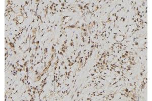 ABIN6278171 at 1/100 staining Human gastric tissue by IHC-P. (FDPS 抗体  (Internal Region))