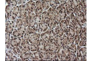Image no. 4 for anti-Rhotekin (RTKN) antibody (ABIN1500702)