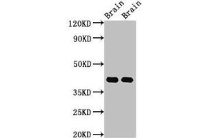Western Blotting (WB) image for anti-Guanine Nucleotide Binding Protein (G Protein), alpha Activating Activity Polypeptide O (GNAO1) (AA 2-354) antibody (ABIN7177257)