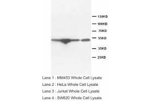 Image no. 2 for anti-Endothelin Receptor Type B (EDNRB) (Internal Region) antibody (ABIN1490394) (EDNRB 抗体  (Internal Region))