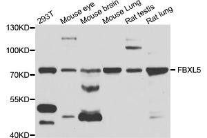 Western blot analysis of extracts of various cell lines, using FBXL5 antibody (ABIN1876803) at 1:1000 dilution. (FBXL5 抗体)