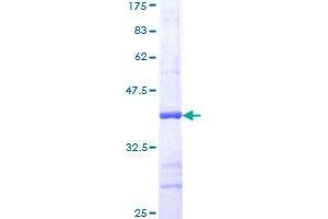 MEK1 Protein (AA 294-393) (GST tag)