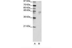 Image no. 1 for anti-Zinc Finger Protein 419 (ZNF419) (C-Term) antibody (ABIN202693) (ZNF419 抗体  (C-Term))