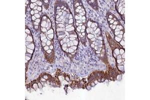 Immunohistochemical staining of human rectum with HIGD1A polyclonal antibody  shows strong cytoplasmic positivity in glandular cells at 1:20-1:50 dilution. (HIGD1A 抗体)