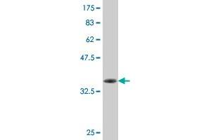 Western Blot detection against Immunogen (37. (SIK2 抗体  (AA 467-576))