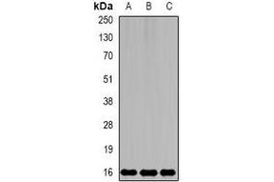 Western blot analysis of MsrB2 expression in mouse kidney (A), mouse brain (B), rat liver (C) whole cell lysates. (MSRB2 抗体)