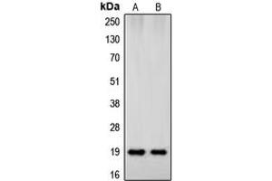 Western blot analysis of Beta-synuclein expression in HeLa (A), human brain (B) whole cell lysates. (beta Synuclein 抗体  (C-Term))