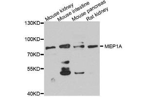 Western blot analysis of extracts of various cell lines, using MEP1A antibody. (MEP1A 抗体  (AA 440-700))
