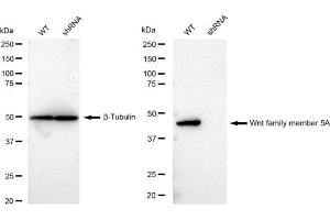 Western blotting analysis using Wnt family member 5A antibody (ABIN7800863).