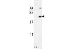 Western blot analysis of IL17F antibody and 293 cell lysate (2 ug/lane) either nontransfected (Lane 1) or transiently transfected with the IL17F gene (2). (IL17F 抗体  (AA 16-45))