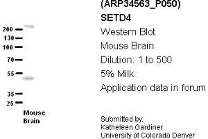 Image no. 2 for anti-SET Domain Containing 4 (SETD4) (C-Term) antibody (ABIN404949) (SETD4 抗体  (C-Term))