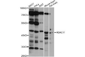 Western blot analysis of extracts of various cell lines, using HDAC11 antibody (ABIN5975404) at 1/1000 dilution. (HDAC11 抗体)