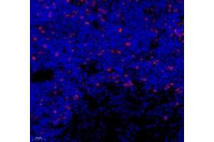 Immunofluorescence of paraffin embedded rat thymus using Top2 (ABIN7075937) at dilution of 1:500 (400x lens) (Topoisomerase II alpha 抗体)