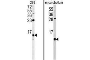 Image no. 1 for anti-FK506 Binding Protein 1B, 12.6 KDa (FKBP1B) (N-Term) antibody (ABIN453013) (FKBP1B 抗体  (N-Term))