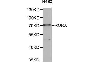 Western blot analysis of extracts of H460 cells, using RORA antibody (ABIN5974193) at 1/1000 dilution.