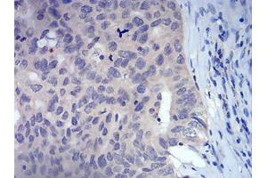 Immunohistochemistry (IHC) image for anti-Forkhead Box P3 (FOXP3) (AA 297-431) antibody (ABIN5542315)