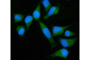 IF analysis of GNB3 using anti-GNB3 antibody (ABIN7599726).