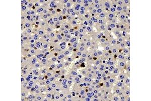 Immunohistochemistry of paraffin embedded mouse liver using IL-2 Receptor alpha (ABIN7074349) at dilution of 1: 200 (400x lens) (CD25 抗体)