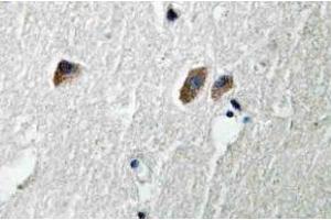 Immunohistochemistry (IHC) analyzes of CaMKIIbeta/gamma/delta antibody in paraffin-embedded human brain tissue. (CAMK2B 抗体)