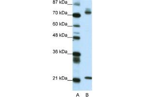 WB Suggested Anti-SATB1 Antibody Titration: 0. (SATB1 抗体  (C-Term))