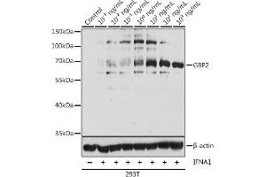Western blot analysis of extracts of 293T cells, using GBP2 antibody  at 1:1000 dilution. (GBP2 抗体  (AA 410-520))