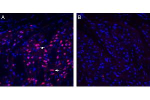 Expression of EphA1 in rat striatum.