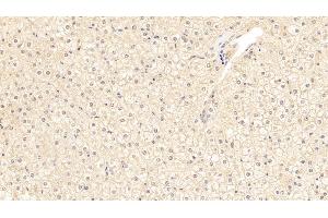 Detection of a1ACT in Human Liver Tissue using Polyclonal Antibody to Alpha-1-Antichymotrypsin (a1ACT) (SERPINA3 抗体  (AA 235-394))