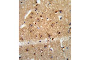 Immunohistochemistry (Paraffin-embedded Sections) (IHC (p)) image for anti-Glial Cell Line Derived Neurotrophic Factor (GDNF) (AA 8-36), (N-Term) antibody (ABIN652624)