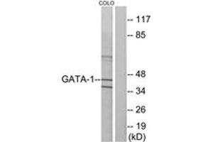 Western blot analysis of extracts from COLO cells, using GATA1 (Ab-142) Antibody. (GATA1 抗体  (AA 109-158))