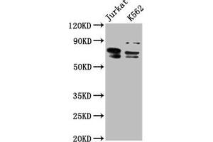 Western Blot Positive WB detected in: Jurkat whole cell lysate, K562 whole cell lysate All lanes: THEMIS antibody at 7. (THEMIS 抗体  (AA 547-641))