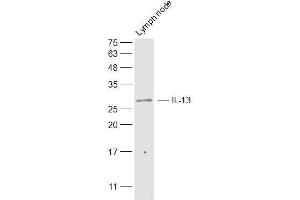 Mouse lymph node lysates probed with IL-13 Polyclonal Antibody, Unconjugated  at 1:500 dilution and 4˚C overnight incubation. (IL-13 抗体  (AA 45-56))