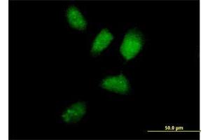 Immunofluorescence of purified MaxPab antibody to RNF8 on HeLa cell.
