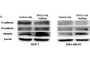 Western Blotting (WB) image for anti-Cadherin 1, Type 1, E-Cadherin (Epithelial) (CDH1) (AA 401-500) antibody (ABIN1387847)