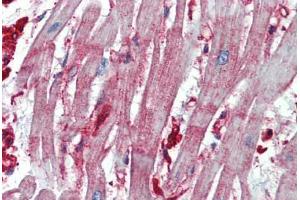 Human Heart: Formalin-Fixed, Paraffin-Embedded (FFPE) (beta Actin 抗体  (AA 359-368))