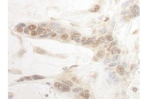 anti-AT Rich Interactive Domain 3B (BRIGHT-Like) (ARID3B) (AA 511-561) antibody