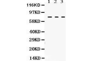 Anti- TGM2 Picoband antibody, Western blotting All lanes: Anti TGM2  at 0. (Transglutaminase 2 抗体  (N-Term))