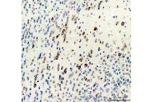 IHC analysis of Survivin/Calcitonin/CALCA using anti-Survivin/Calcitonin/CALCA antibody (ABIN4886497). (CGRP 抗体  (C-Term))