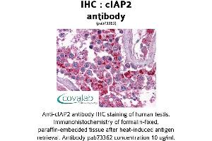 Image no. 2 for anti-Baculoviral IAP Repeat Containing 3 (BIRC3) (AA 314-508) antibody (ABIN1733088)