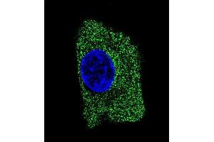 Confocal immunofluorescent analysis of LP2 Antibody 1851b with HepG2 cell followed by Alexa Fluor® 488-conjugated goat anti-mouse lgG (green). (LAMP2 抗体)