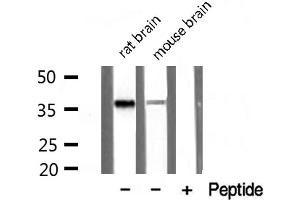 Western blot analysis of extracts of various tissue sample,using PDLIM1 Antibody . (PDLIM1 抗体  (Internal Region))