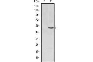 Western Blotting (WB) image for anti-Methylenetetrahydrofolate Reductase (NAD(P)H) (MTHFR) antibody (ABIN969297)