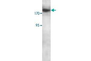 Western blot analysis of Jurkat cell lysate with RBBP6 polyclonal antibody  at 1 : 250 dilution. (RBBP6 抗体  (C-Term))